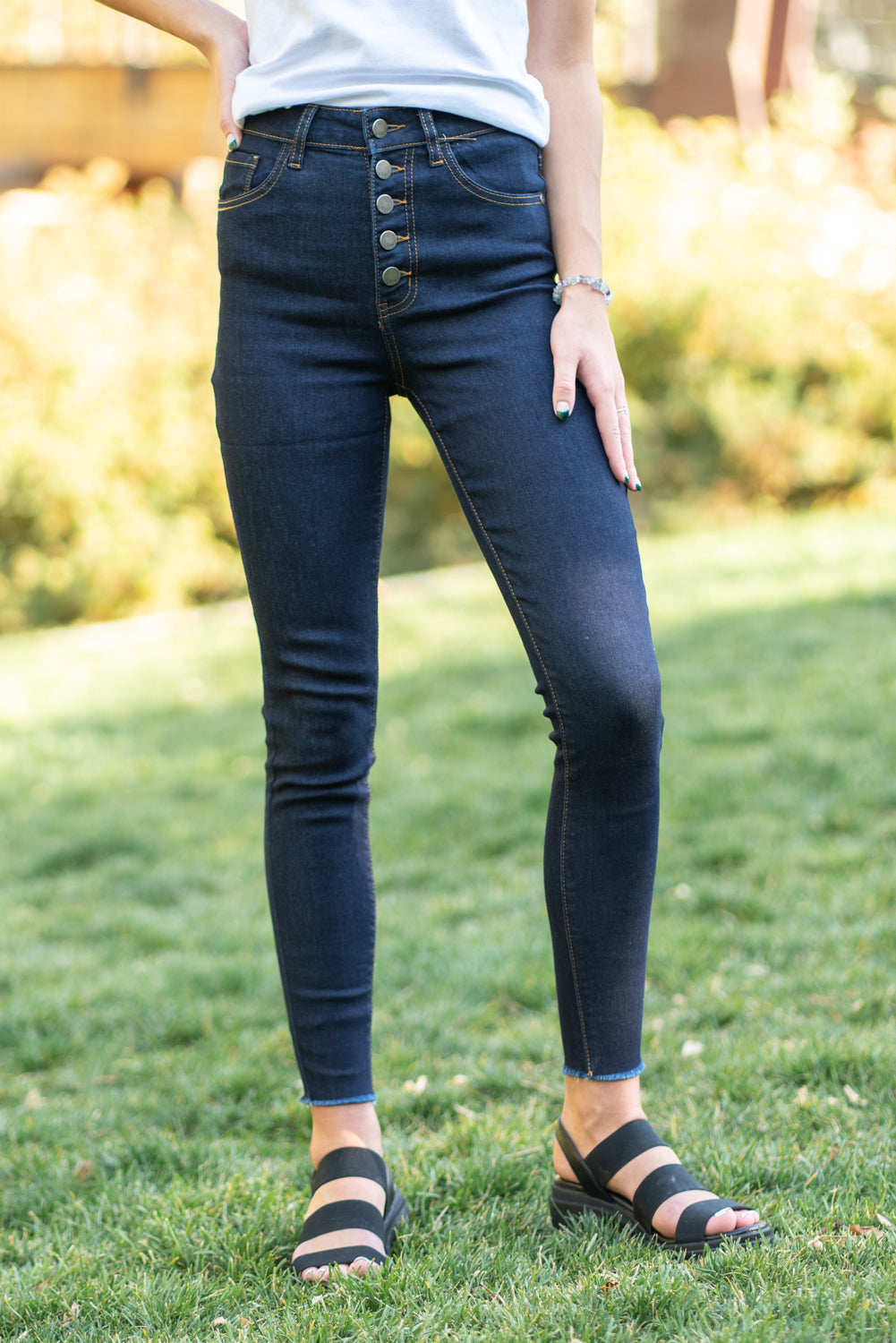 Jeans with exposed fashion buttons